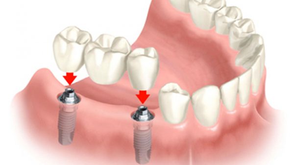 ধূমপান করেন, দাঁতের যত্নে যা করবেন