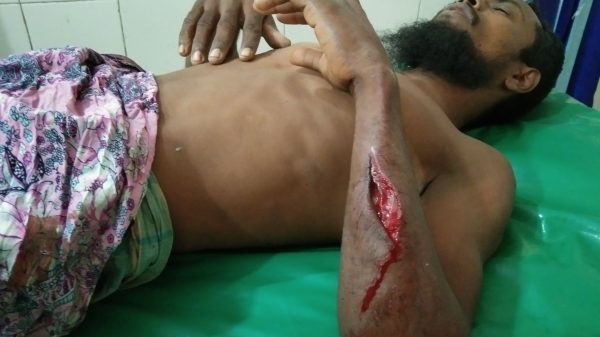 বাউফলে টাকা চুরি’র ঘটনাকে কেন্দ্র করে এক যুবককে কুপিয়ে জখম