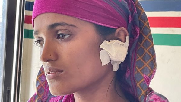 বাউফলে স্ত্রীর কান কেটে দিল পাষন্ড স্বামী