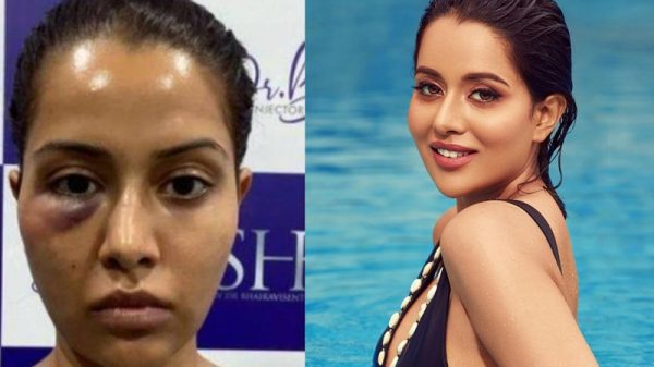 সৌন্দর্য বাড়াতে গিয়ে বিপাকে অভিনেত্রী